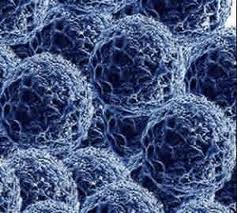 silver nanoparticles